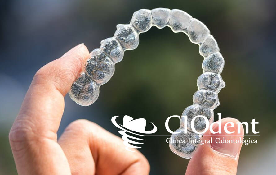 precio invisalign madrid