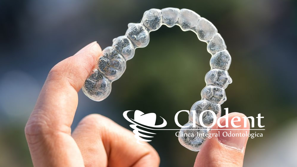 precio invisalign madrid