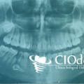 Clínica dental: La importancia de un buen diagnóstico inicial