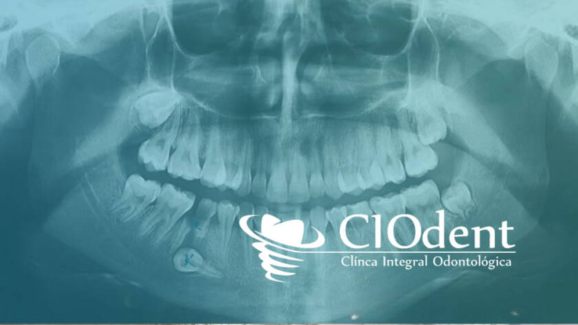 importancia diagnostico clinica dental