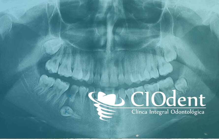 importancia diagnostico clinica dental