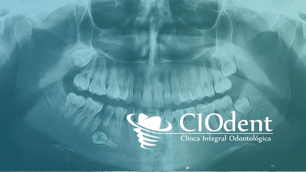 importancia diagnostico clinica dental