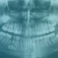 Clínica dental: La importancia de un buen diagnóstico inicial
