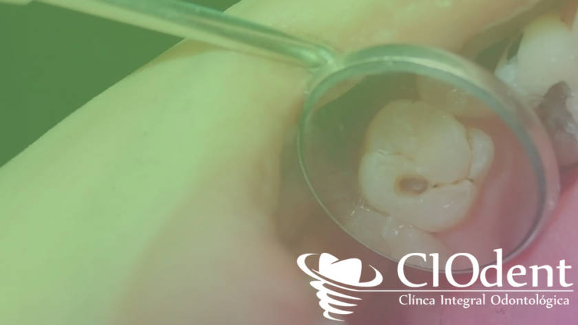 dentista-ninos-madrid-ciodent