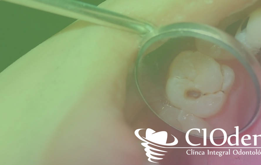 dentista-ninos-madrid-ciodent