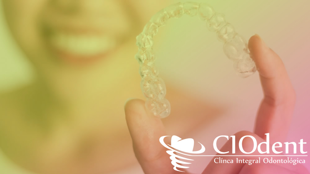precio-invisalign-madrid-ciodent