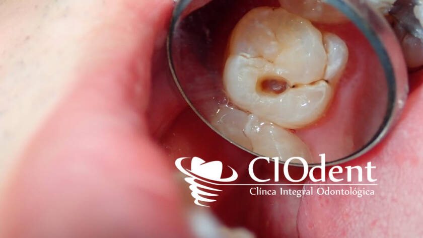 dentista para ninos en madrid