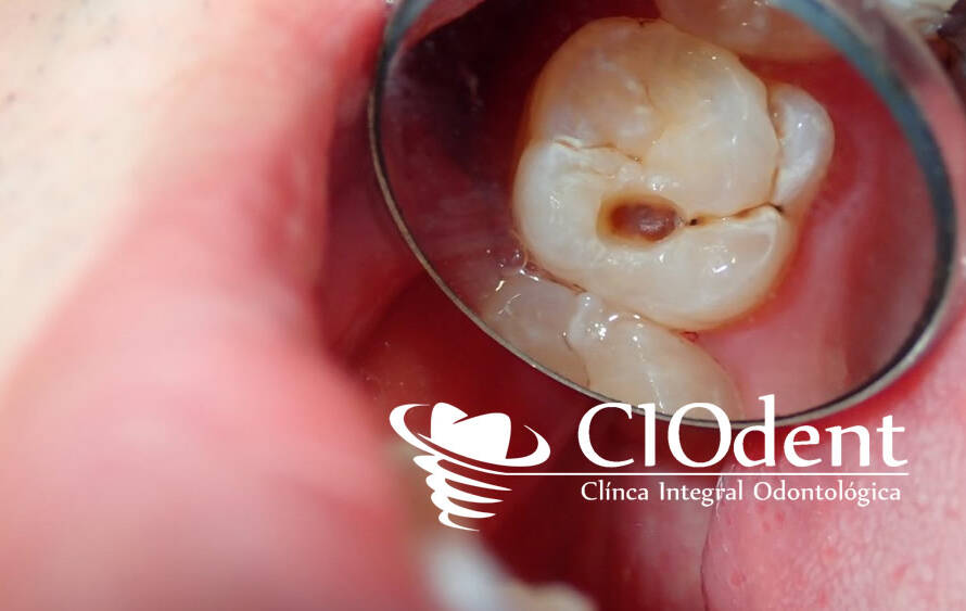 dentista para ninos en madrid