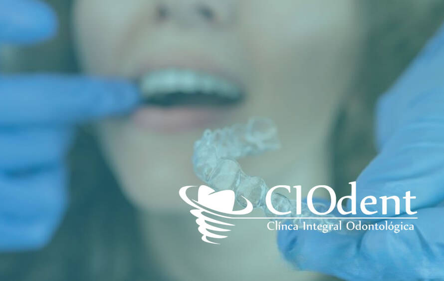 descubre beneficios ortodoncia invisible