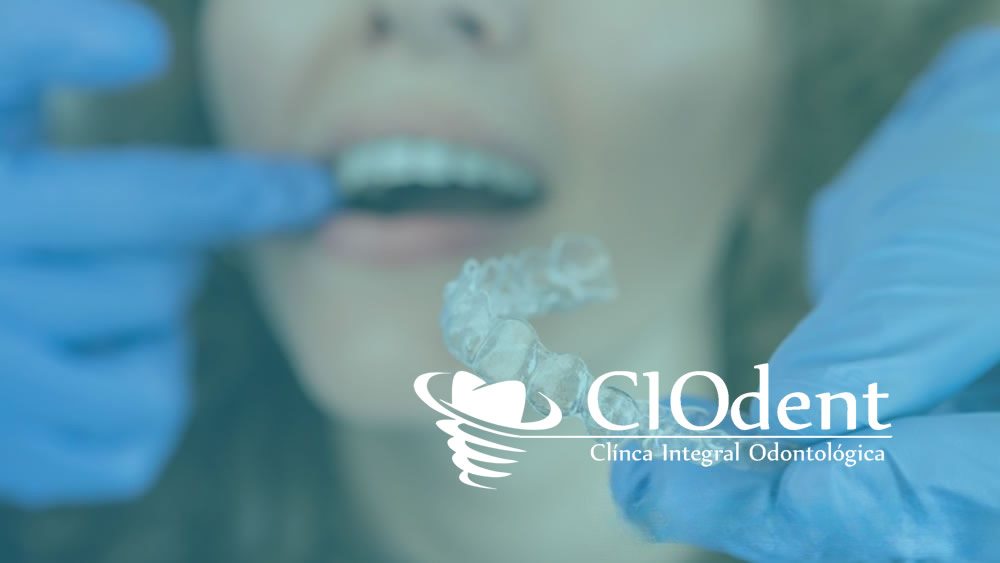 descubre beneficios ortodoncia invisible