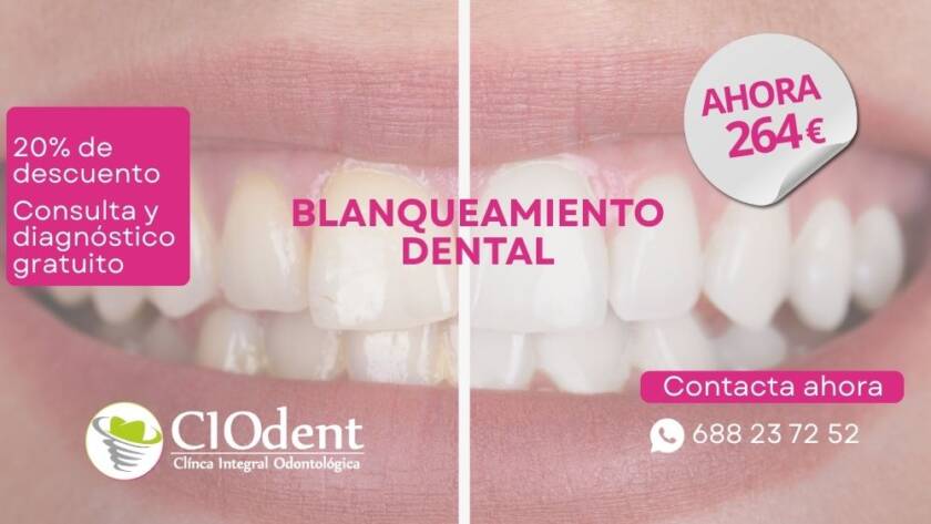 Blanquea tu sonrisa con 20% de descuento hasta fin de año | CIO dent Madrid