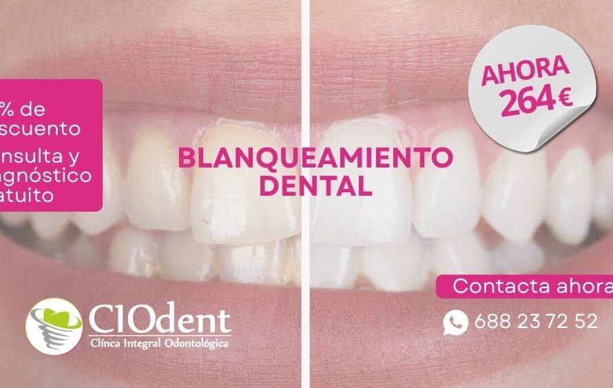 Blanquea tu sonrisa con 20% de descuento hasta fin de año | CIO dent Madrid