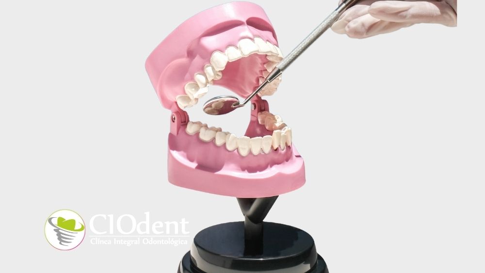 señales de alerta de la enfermedad periodontal