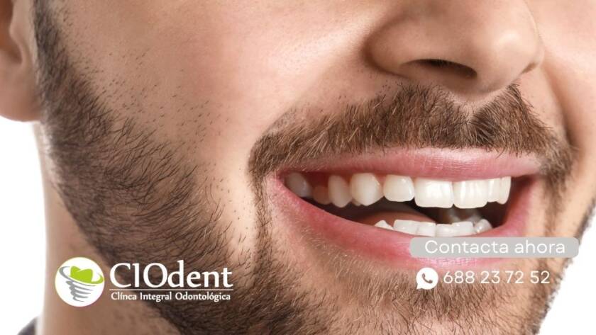 Cada Cuánto Ir al Dentista: Recomendaciones por Edades