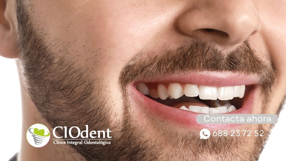 Cada Cuánto Ir al Dentista: Recomendaciones por Edades