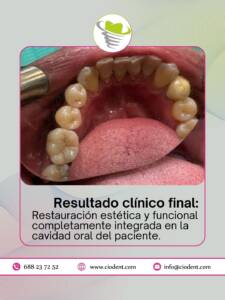 implante-dental-completo-04